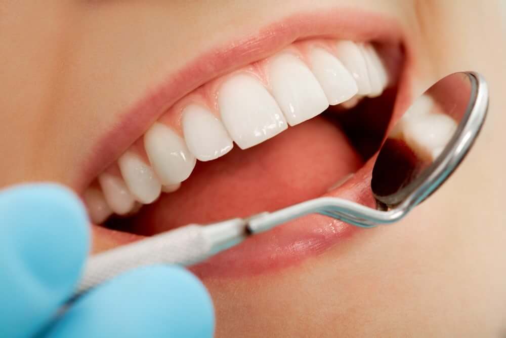 Immune cells may play a role in causing cavities